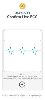 Confirm Live ECG screen showing a real-time waveform before proceeding